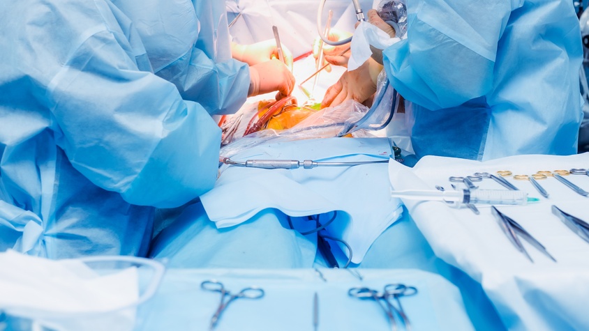 Chirurgie Laparoscopique oncologique et de la paroi abdominale
